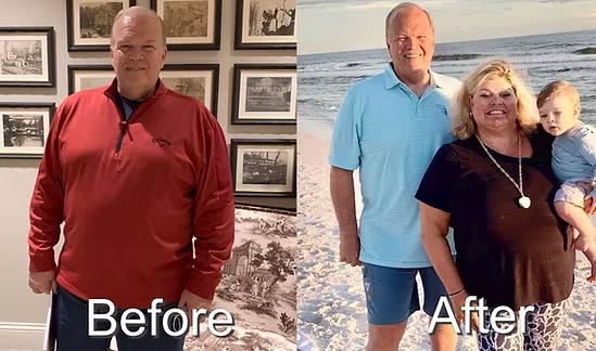 Before and After Images of Patients at NY Medical Weight Loss in Garden City, NY Before and After Images of Patients at NY Medical Weight Loss in Garden City, NY
